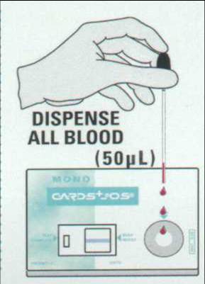 1) Dispensare 3 gocce di sangue nel pozzetto predisposto